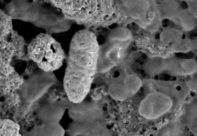 Cover image for research topic "Urinary Tract Infections: Molecular Mechanisms of Pathogenesis"