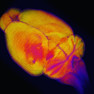 Cover image for research topic "Translatable Models and MRI Methods for Neurodegenerative Diseases"