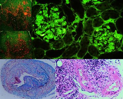 Cover image for research topic "Host Immune Responses to Retroviral Infections"