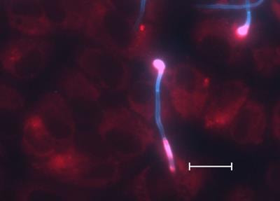 Cover image for research topic "Exploring novel experimental systems to study the mechanistic basis of fungal infections"