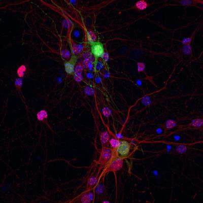 Cover image for research topic "Defective DNA Damage Response – Repair Axis in Post-Mitotic Neurons in Human Health and Neurodegenerative Diseases"
