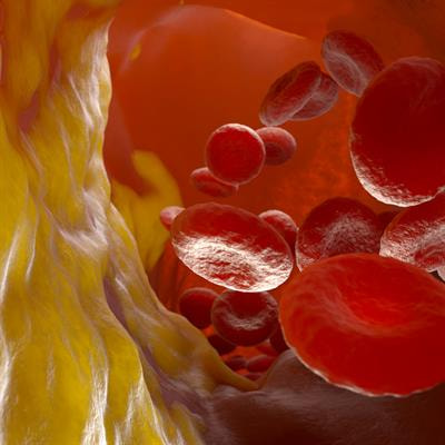 Cover image for research topic "Statin Therapy: Controversial issues"