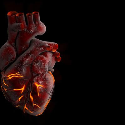 Cover image for research topic "Strategies to Improve Management of Ventricular Tachycardias"