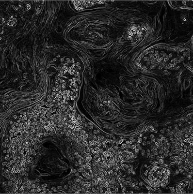 Cover image for research topic "Heating up "Cold" Tumors for a More Effective Response to Immune Checkpoints Inhibitors"