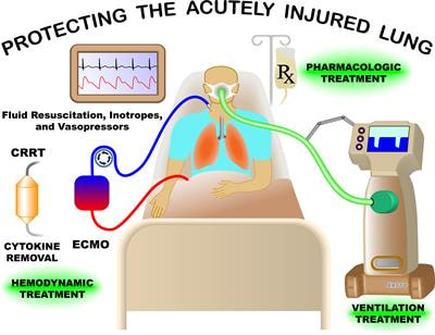 Cover image for research topic "Protecting the Acutely Injured Lung: Physiologic, Mechanical, Inflammatory, and Translational Perspectives"