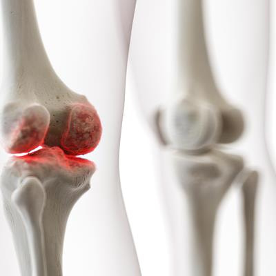 Cover image for research topic "Speaking Nervously about Bone: The Role of the Peripheral Nervous System and Neurotransmitters in Inflammatory Diseases of Bone and Joints"