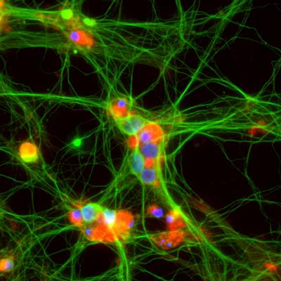 Cover image for research topic "Novel mechanisms involved in aging and neurodegeneration: Seeking potential therapeutic targets for neurodegenerative diseases."