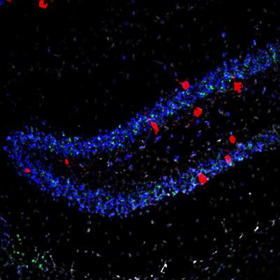 Cover image for research topic "Brain Cells’ Compensatory Mechanisms in Response to Disease Risk Factors"