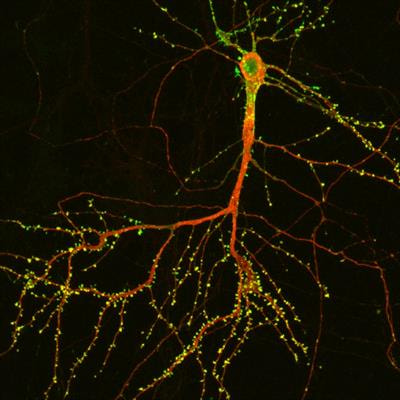 Cover image for research topic "Autism Spectrum Disorders: Underlying Molecular and Cellular Mechanisms of Neuroplasticity and Development"