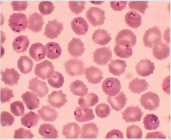 Cover image for research topic "Pathogenesis of Cerebral Malaria: New Tools, Recent Discoveries and Innovative Therapeutic Approaches"