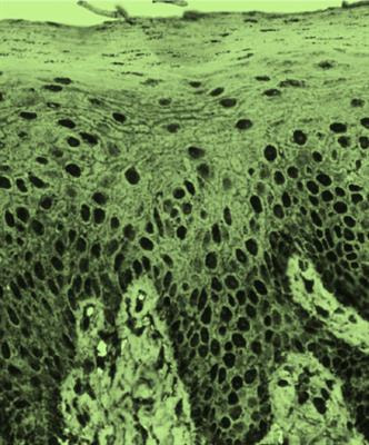 Cover image for research topic "Recent Advances in Immune-Stromal Interactions in Autoimmune & Autoinflammatory Skin Diseases"