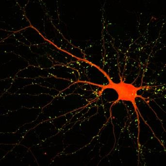 Cover image for research topic "Molecular Mechanisms of Glutamatergic Synapse Function and Dysfunction"