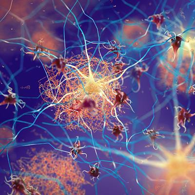 Cover image for research topic "Brain Disease Mechanisms - Editor’s Picks 2021"