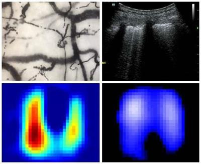 Cover image for research topic "Bedside Visual Image Technologies for Respiratory and Circulatory Management in Intensive Care Settings"