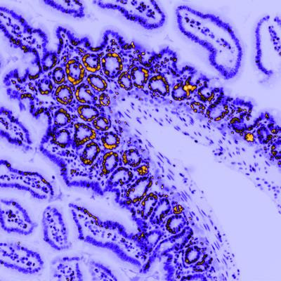 Cover image for research topic "Current Advances in Precision Microscopy"