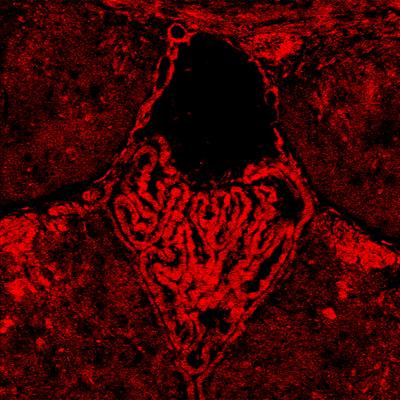 Cover image for research topic "The role of choroid plexus in brain disorders"