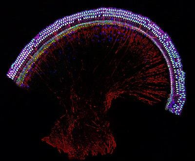 Cover image for research topic "Inner Ear Biology: Development, Physiopathology, Repair and Recovery"