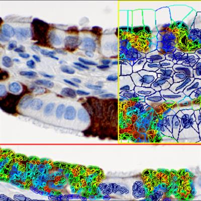 Cover image for research topic "Molecular Pathology and Computational Image Analyses in Gynecologic Malignancies"