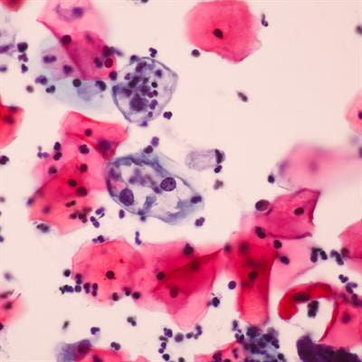 Cover image for research topic "Insights in Genitourinary Oncology: 2021"