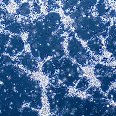 Cover image for research topic "Insights in Neuro-Oncology and Neurosurgical Oncology: 2021"