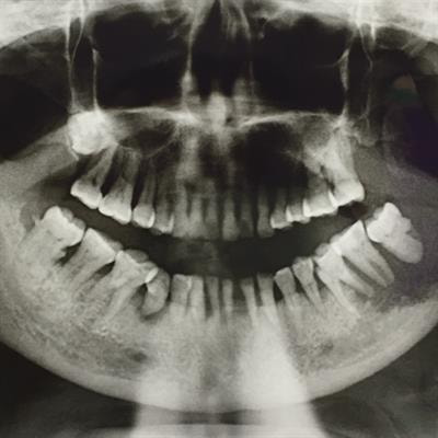Cover image for research topic "Insights in Head and Neck Cancer: 2021"
