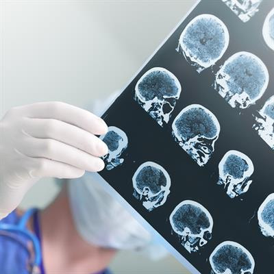 Cover image for research topic "Brain Health and Clinical Neuroscience Editor's Pick 2021"