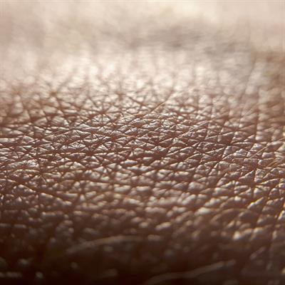 Cover image for research topic "Insights in Skin Cancer: 2021"