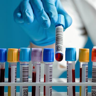 Cover image for research topic "Insights in Hematologic Malignancies: 2021"
