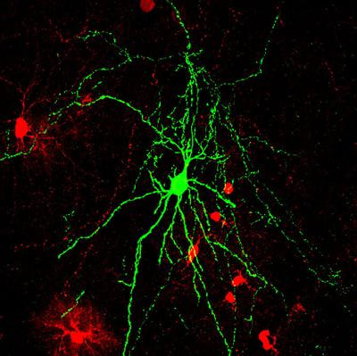 Cover image for research topic "Progenitor diversity and neural cell specification in the central nervous system"