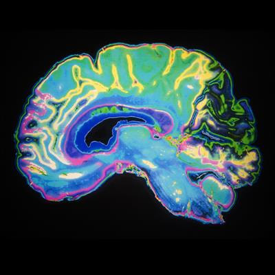Cover image for research topic "Brain Imaging and Stimulation Editor's Pick 2021"