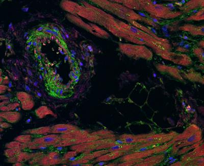 Cover image for research topic "Exploring the Crosstalk Between Adipose Tissue and the Cardiovascular System"