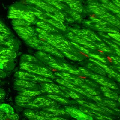 Cover image for research topic "Myocardium Regeneration and Cardioprotection"