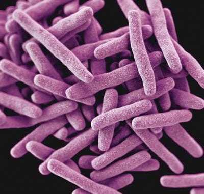 Cover image for research topic "Drug-resistant Mycobacterium tuberculosis"