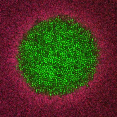 Cover image for research topic "Exploring Bacterial Colonies in Solid Foods or Model Foods Using Non-Destructive Techniques"