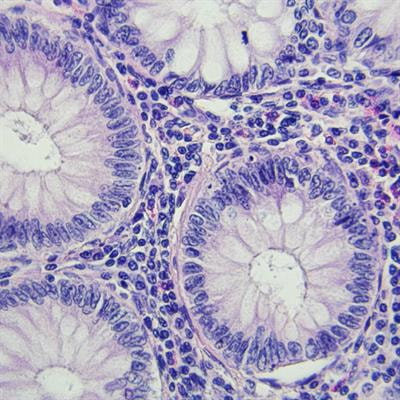 Cover image for research topic "Rising Stars in Cancer Metabolism 2022"