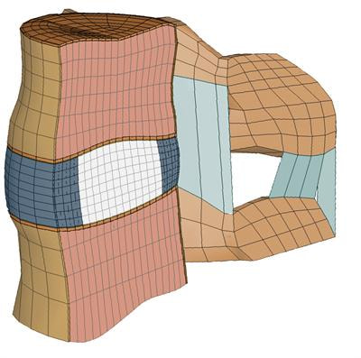 Cover image for research topic "Advances in computational modeling of orthopedic degenerative diseases"