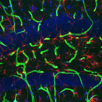 Cover image for research topic "Changes in Metabolic Processes Affecting Brain Development"