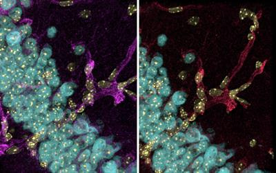 Cover image for research topic "Endo- and Transcytotic Pathways at the Brain Barriers"