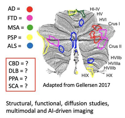 Cover image for research topic "The Role of the Cerebellum in Dementia and Neurodegenerative Diseases"