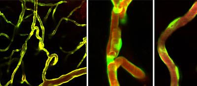 Cover image for research topic "Small and Mighty: Brain Capillaries in Health and Disease"