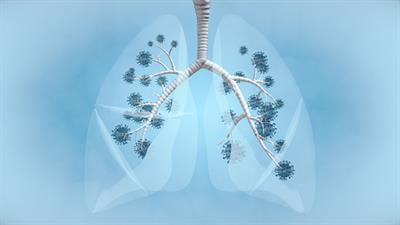 Cover image for research topic "Perioperative Systemic Inflammation in Lung Cancer Surgery"