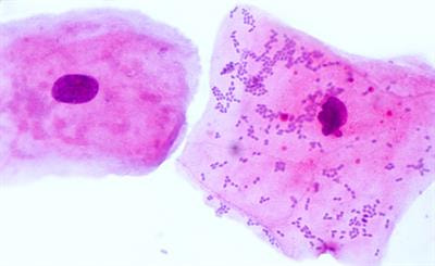 Cover image for research topic "The Interaction between the Oral Microbiota and Systemic Diseases"