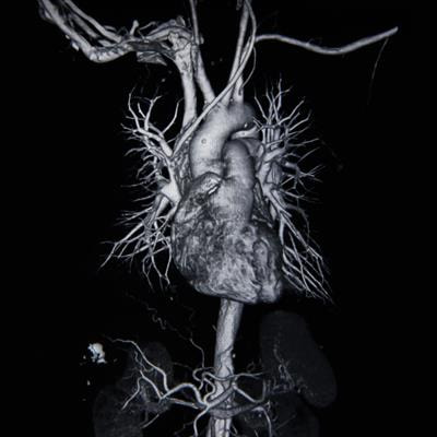 Cover image for research topic "Multi-omics in Cardiomyopathies Causing Heart Failure: From mechanism to treatment"
