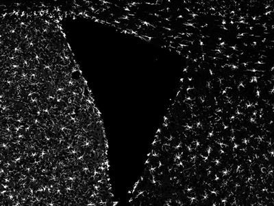 Cover image for research topic "The Role of Microglia in the Pathogenesis of Neurodegenerative Diseases"