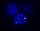 Cover image for research topic "Cancer-associated defects in the DNA damage response: drivers for malignant transformation and potential therapeutic targets."