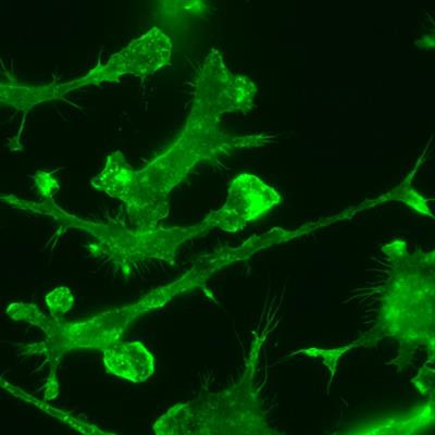 Cover image for research topic "Cell Biology of Microglia"