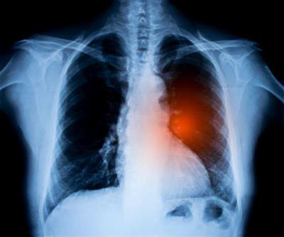 Cover image for research topic "Imaging in Non-Small Cell Lung Cancer"
