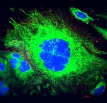 Cover image for research topic "Dysregulation of Protein Folding in Neurodegenerative Disorders"