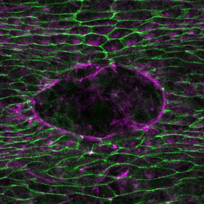 Cover image for research topic "Non-Cadherin Based Cell Adhesion in Tissue Remodeling"