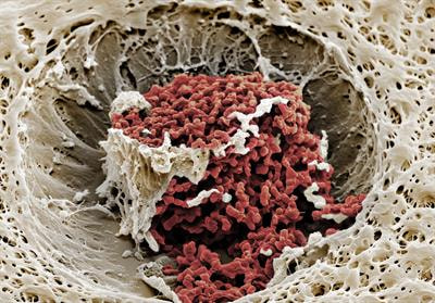 Cover image for research topic "Bone and Joint Infections: Pathogenesis, Immunity, and Diagnosis"